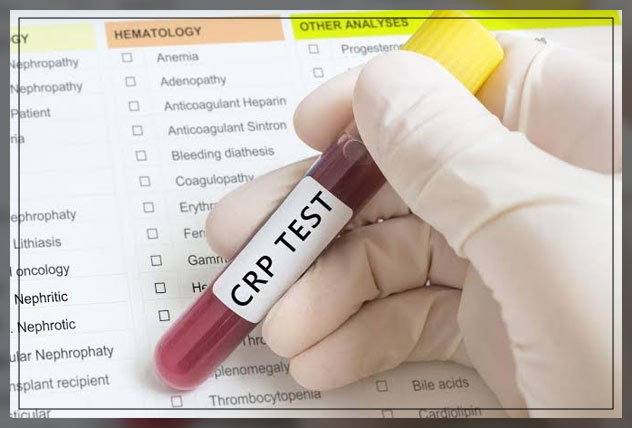 تست CRP