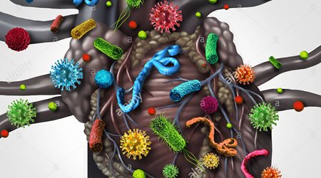 اندوکاردیت 🔗