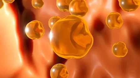 چه غذاهایی کلسترول خون را بالا می برند؟