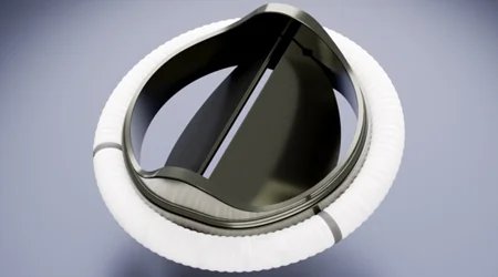 دریچه های فلزی (متالیک)