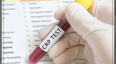 تست CRP