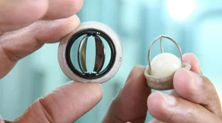 دریچه های مصنوعی